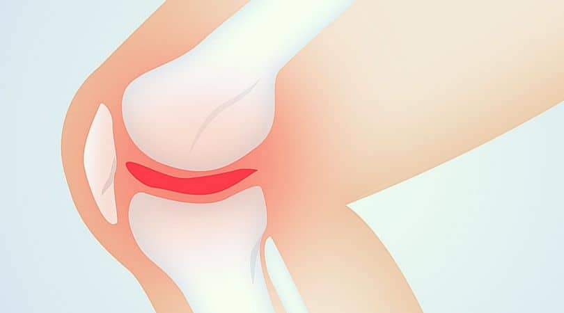 Qué son los meniscos de la rodilla y cuáles son sus lesiones? - Fisiolution